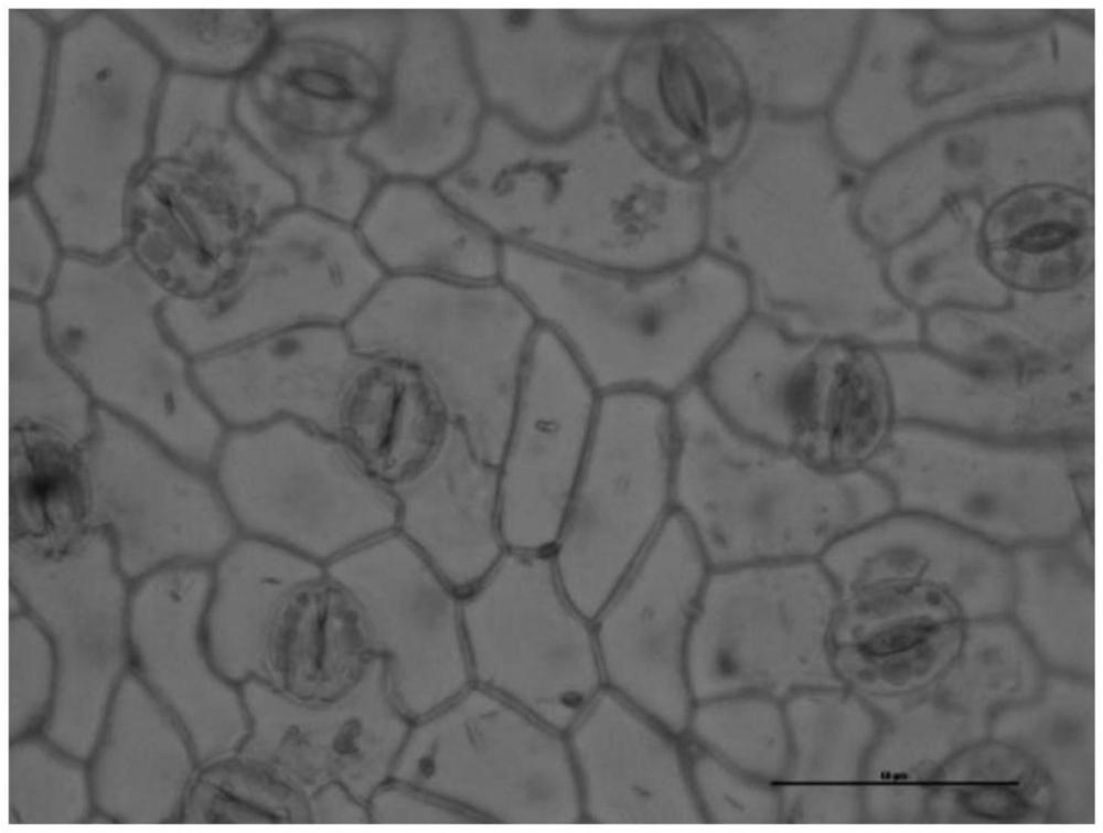 一种简易快速制作植物叶表皮的新方法