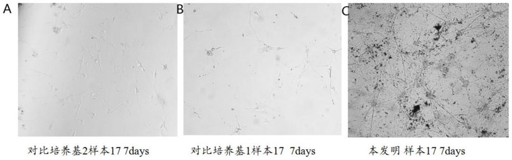 一种神经母细胞瘤原代细胞的培养基及培养方法和应用与流程