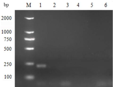 一种基于Fiber1基因的禽安卡拉病毒荧光定量检测方法
