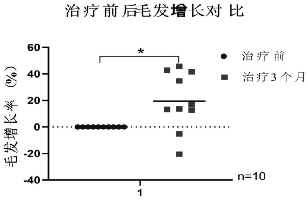 具有脱发再生作用的毛囊干细胞制剂及其制备与应用的制作方法