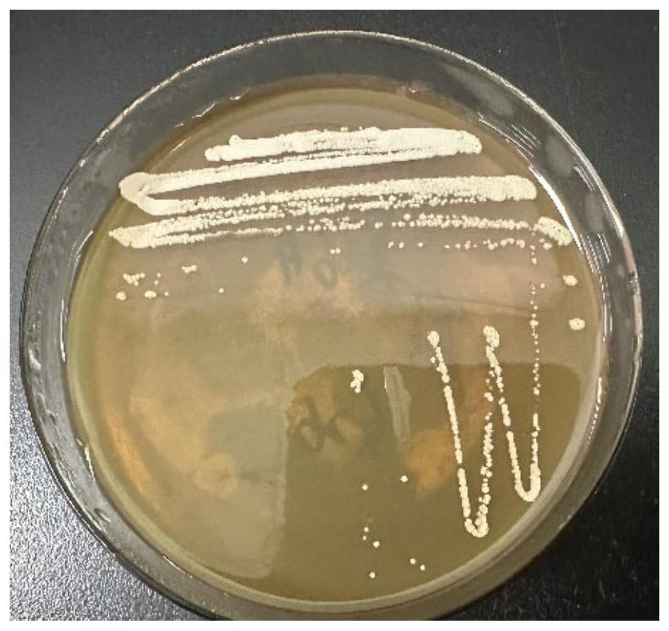 一株毕赤酵母菌及其含毕赤酵母菌的微生物除磷复合菌剂与应用的制作方法