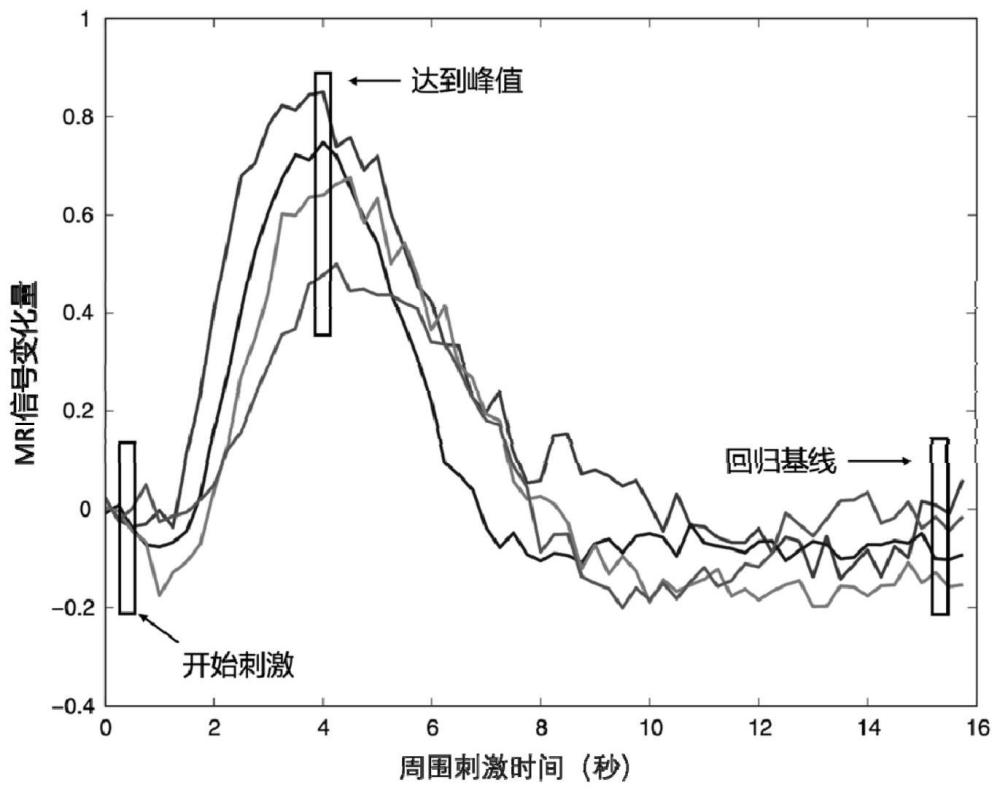 一种基于静息态磁共振成像数据的脑区功能连接分析系统的制作方法