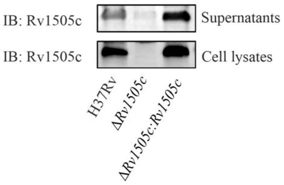一种抗结核分枝杆菌酰基转移酶靶点Rv1505c及其应用