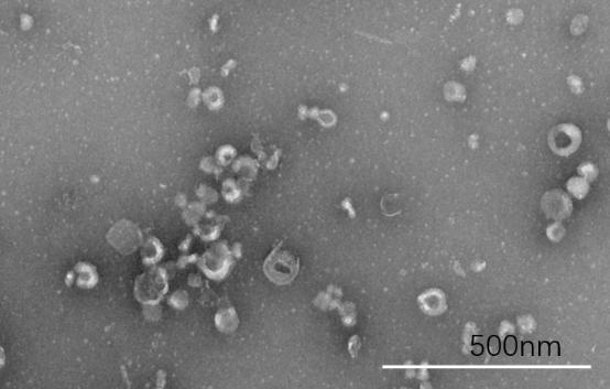 幽门螺旋杆菌外膜囊泡及其制备方法与应用