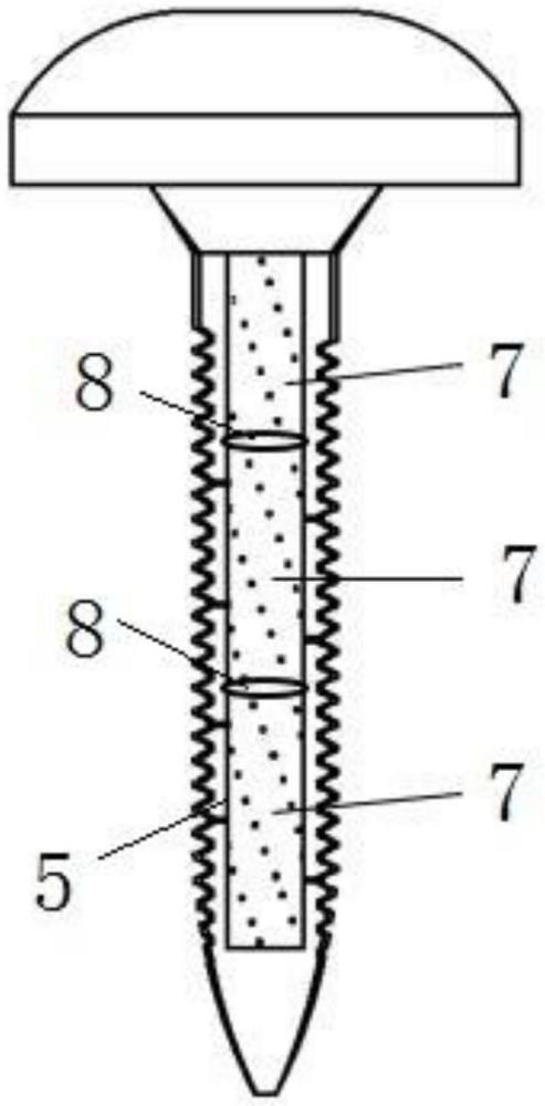 一种可控释放载药骨螺钉
