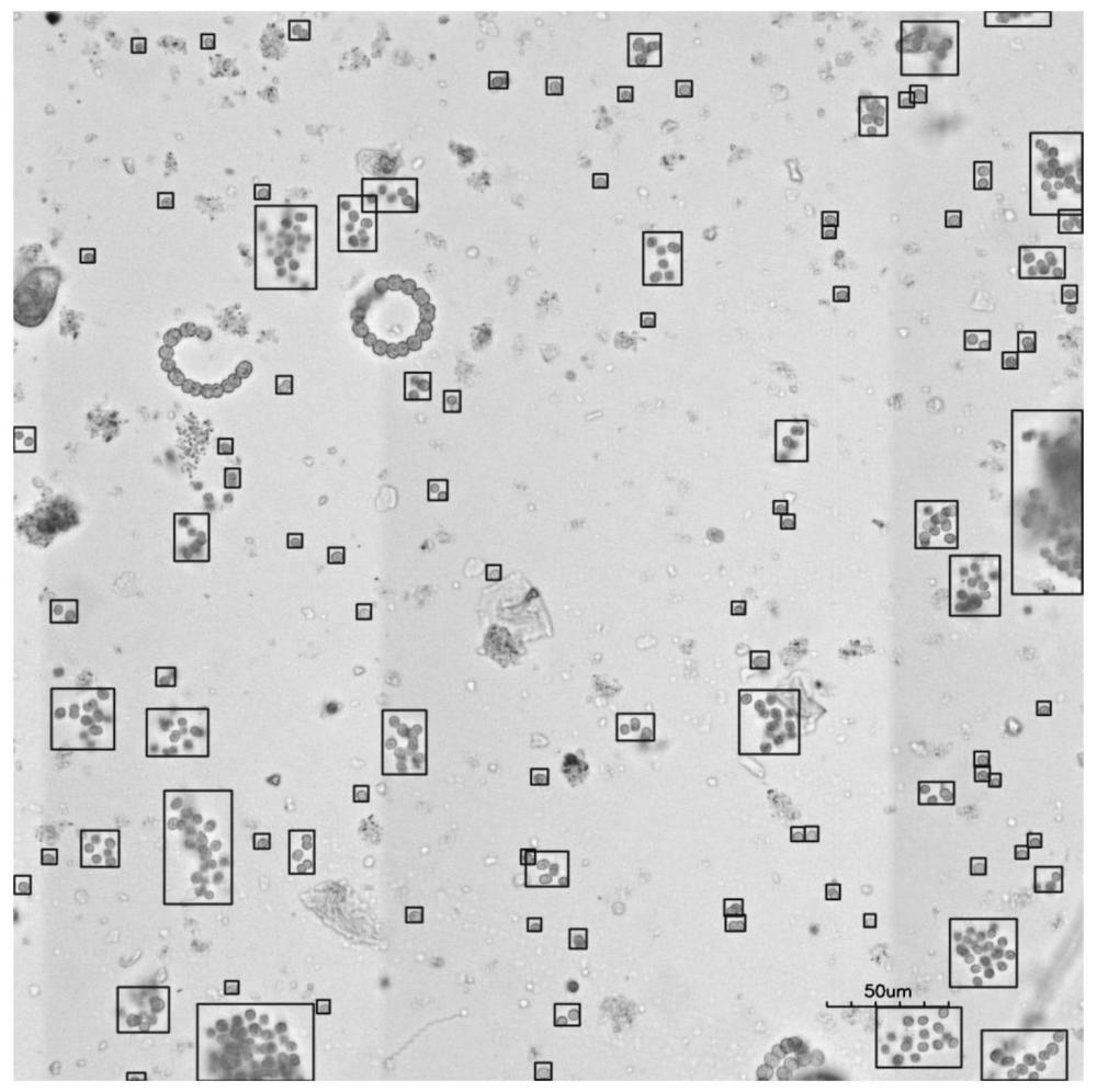 基于图像处理的微囊藻识别计数方法与流程