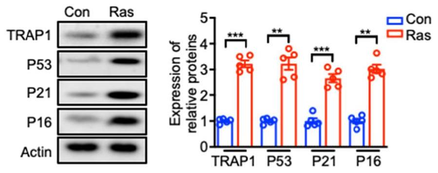 抑制TNF受体相关蛋白1的医药用途