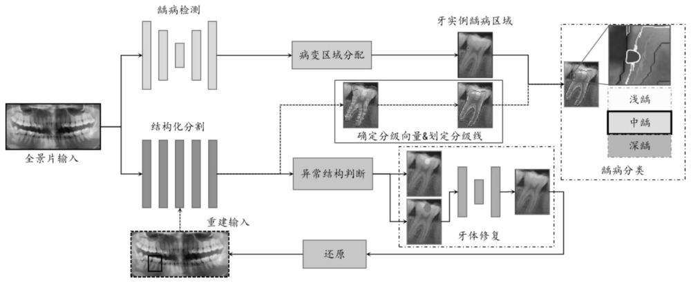 基于牙体修复及结构化分割的龋病程度分类方法