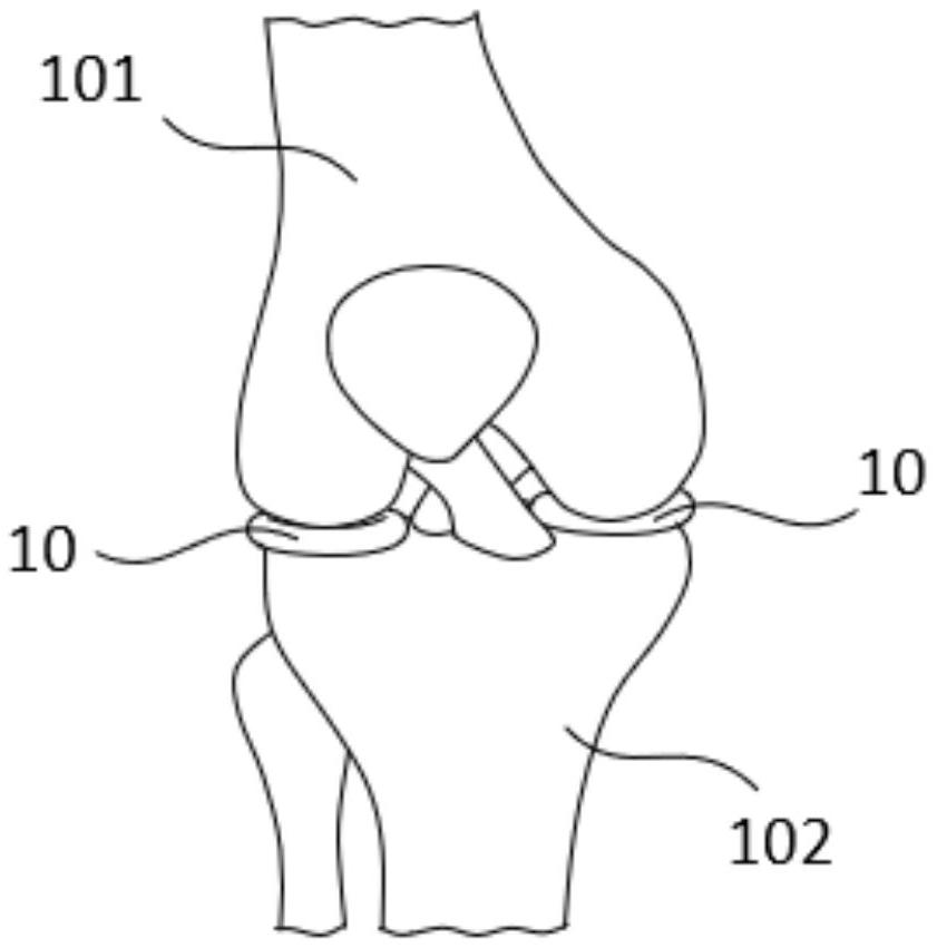 膝关节的辅助装置