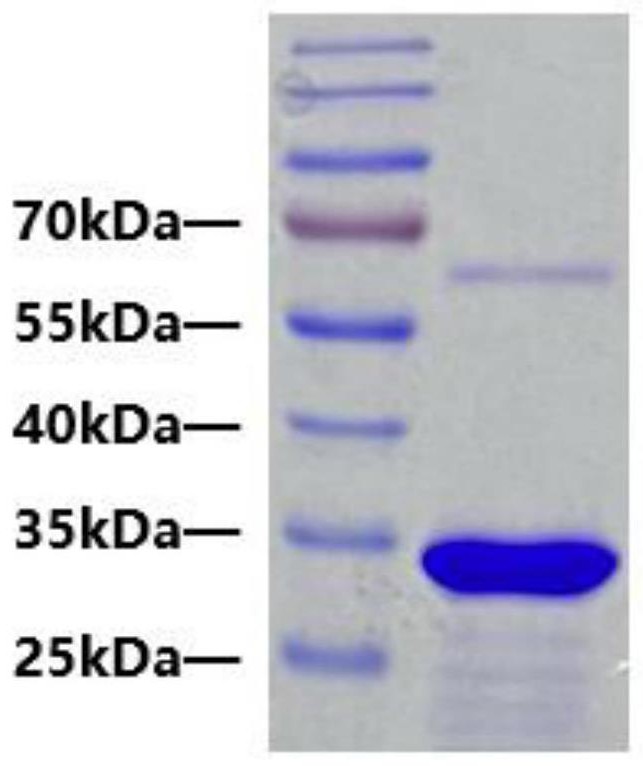 鼠抗人错配修复蛋白MLH1单克隆抗体、细胞株及其应用的制作方法