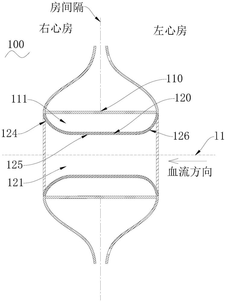 分流器的制作方法