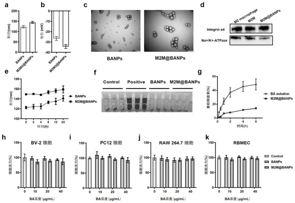 一种调控脑缺血微环境的M2型巨噬细胞膜包裹黄芩苷纳米粒、制备方法及其应用