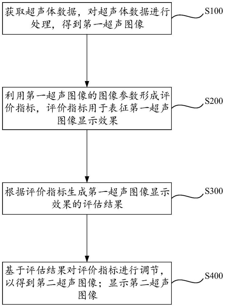 超声图像显示方法、超声设备、计算机设备及存储介质与流程