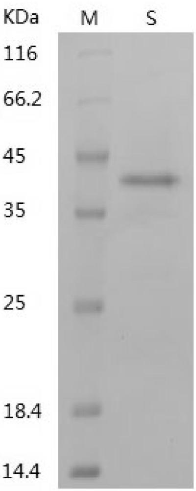 LpPHM的基因片段、重组毕赤酵母及其应用