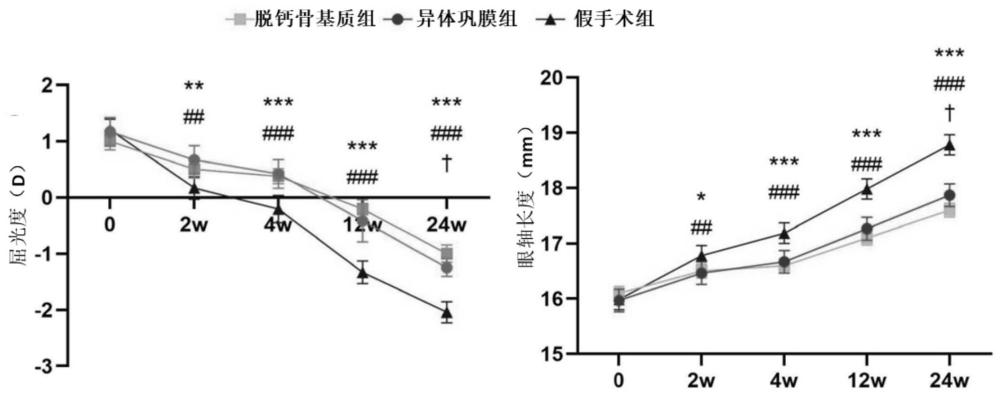 一种后巩膜加固术用加固材料及其制备方法