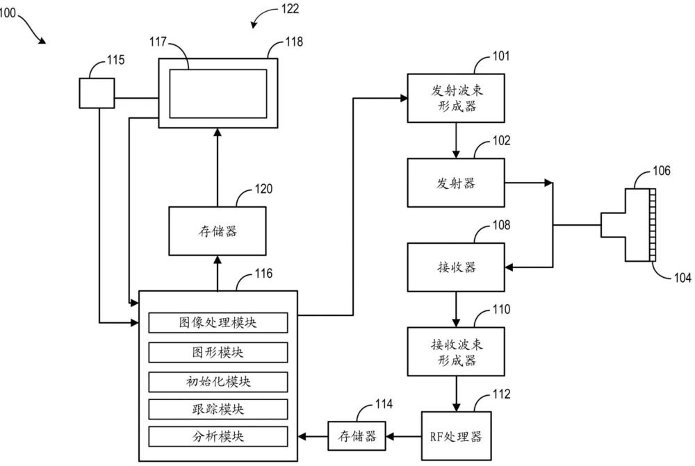 用于超声探头电源管理的方法和系统与流程