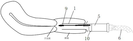 一种可视化宫颈样本自取样装置