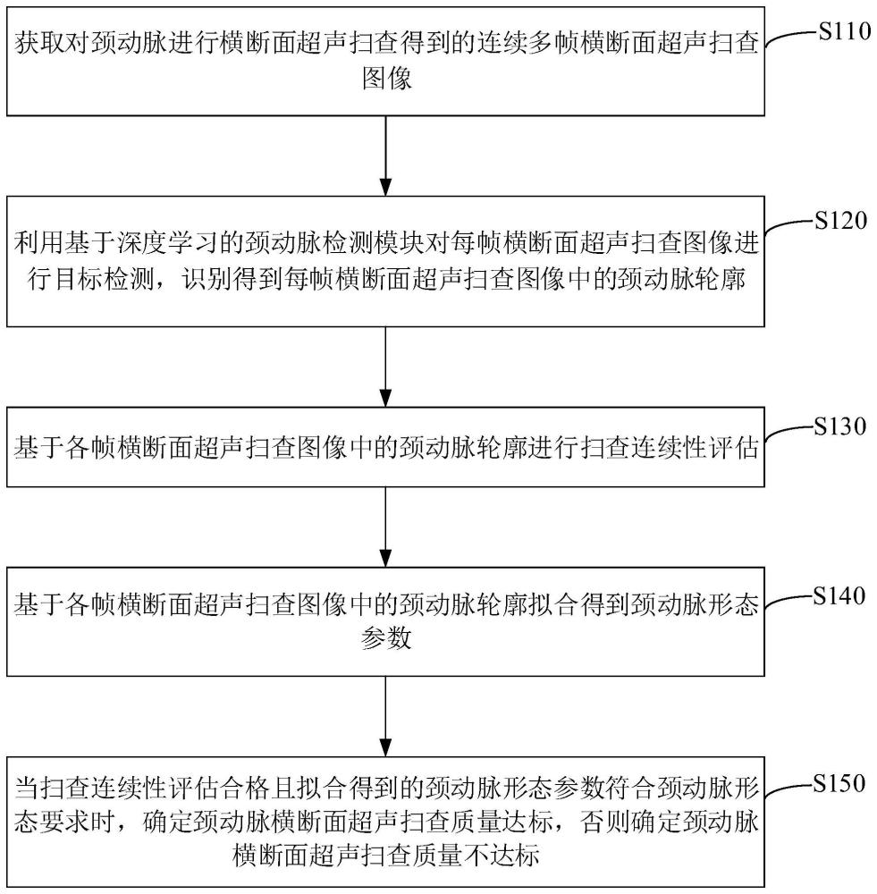 一种颈动脉横断面超声扫查质量评估方法与流程