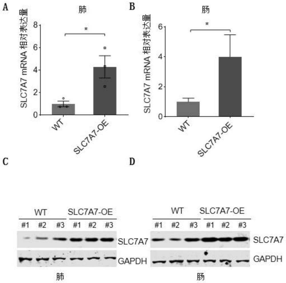 一种条件性过表达人源SLC7A7基因的动物模型的构建方法及其应用