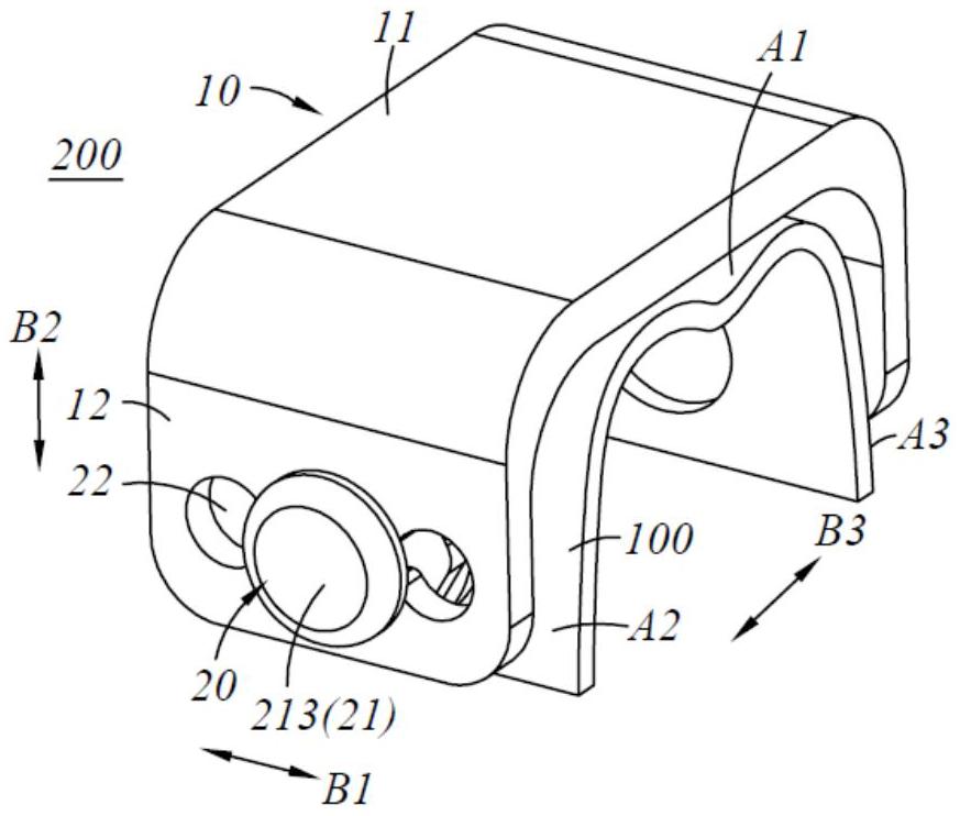 矫治器组件的制作方法