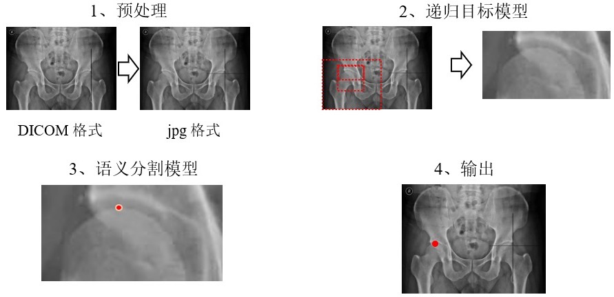 基于递归目标检测与语义分割的医疗影像关键点精确定位方法与流程