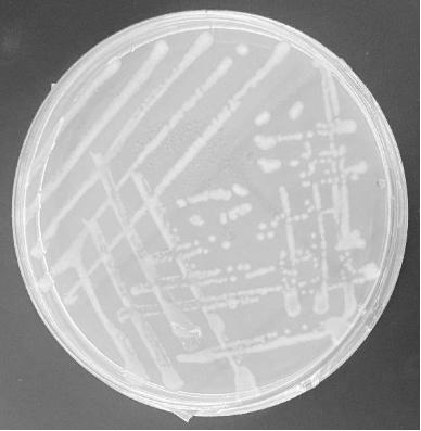 一株中華根瘤菌96-4及其微生物菌肥、微生物菌肥的制備方法與應(yīng)用