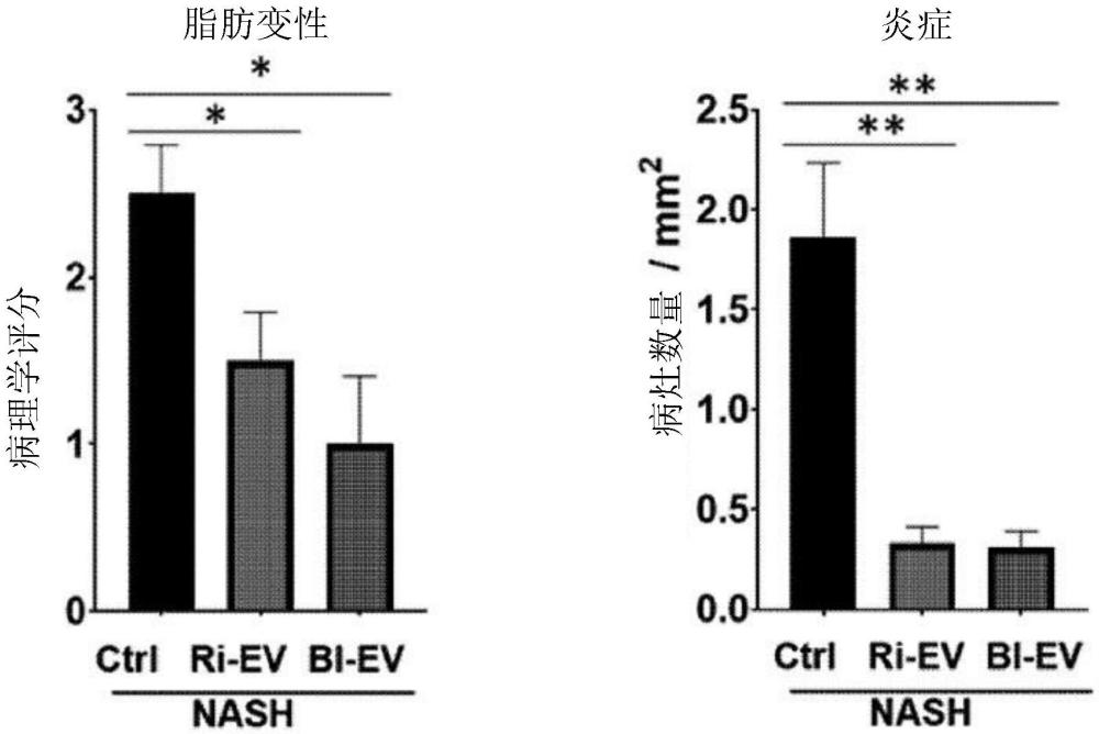 包含源于罗斯氏菌属或双歧杆菌属的细胞外囊泡的用于预防、改善或治疗非酒精性脂肪性肝病的组合物的制作方法