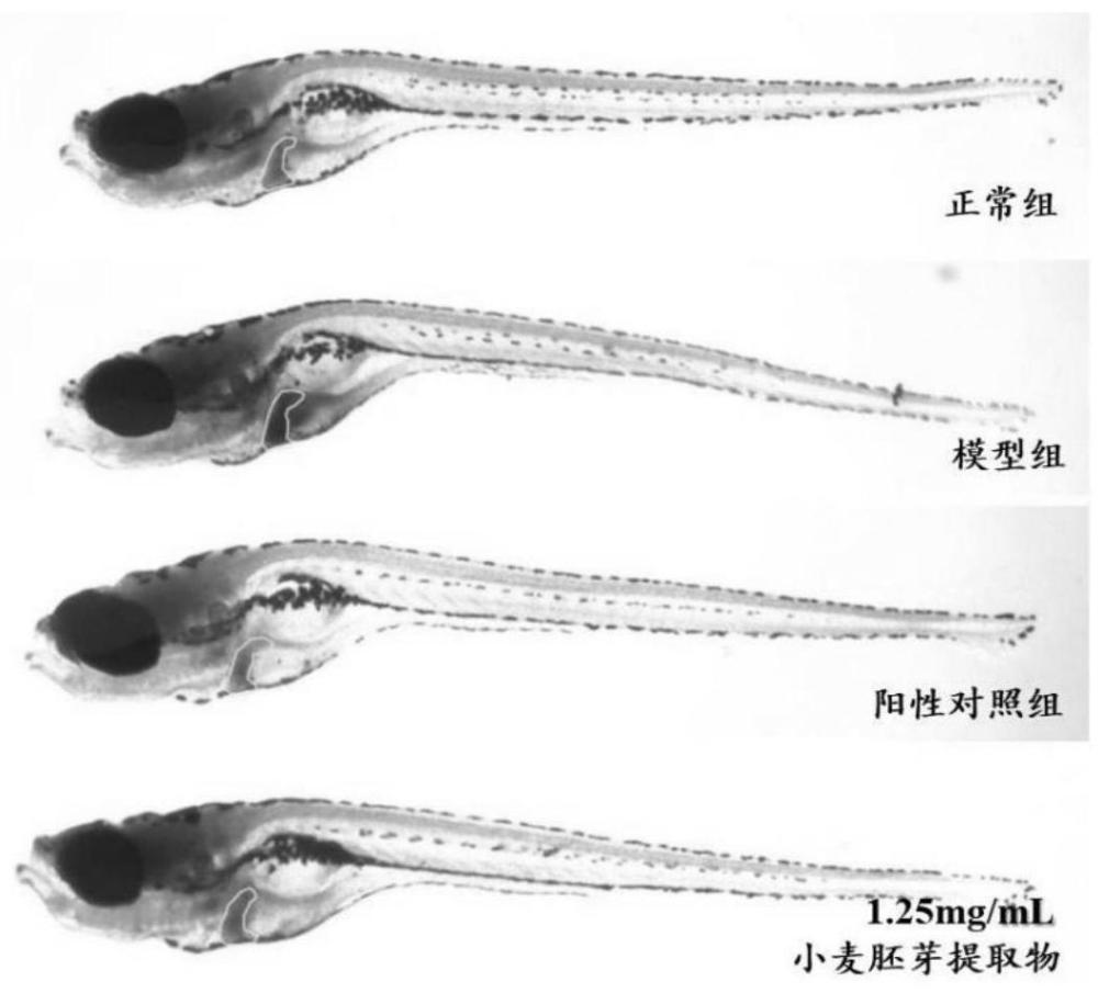 一種小麥胚芽提取物及其制備方法和應(yīng)用與流程