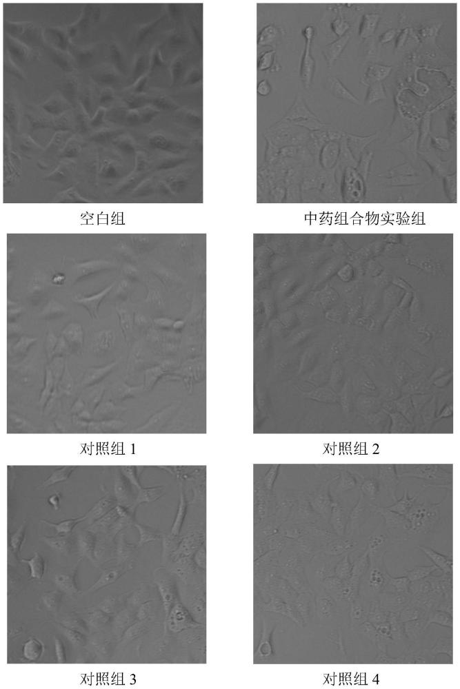 一种治疗肺癌的中药组合物及其制备方法