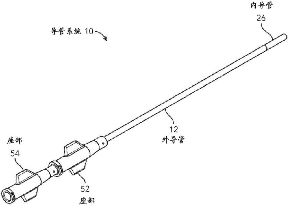 導(dǎo)管系統(tǒng)以及使用方法與流程