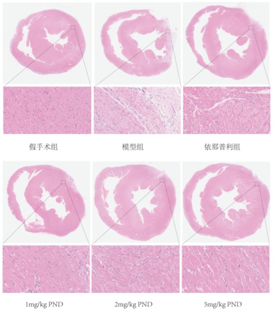 人參環(huán)氧炔醇在制備防治心力衰竭藥物中的應(yīng)用