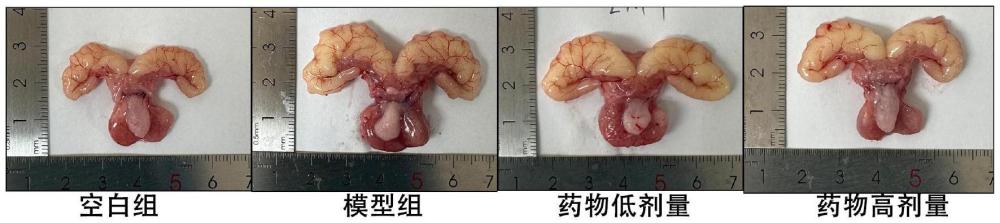 一種防治良性前列腺增生的中藥組合物及其制備方法