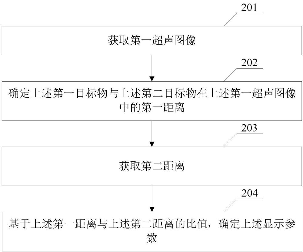 超聲圖像的顯示方法及相關(guān)產(chǎn)品與流程