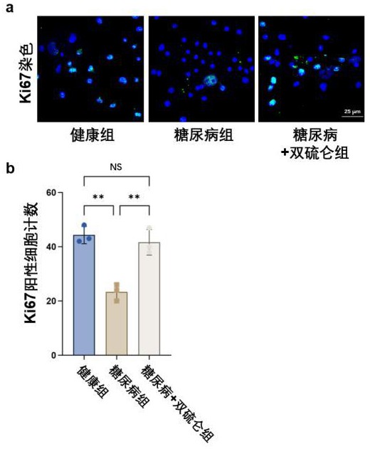 雙硫侖在制備治療糖尿病股骨骨丟失的藥物中的應(yīng)用