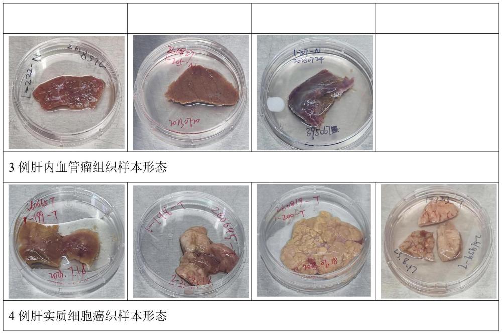 一種用于人源肝組織分離肝實(shí)質(zhì)細(xì)胞的培養(yǎng)液及培養(yǎng)方法與流程