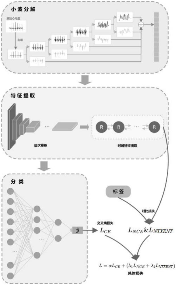 一種基于小波變換的睡眠呼吸暫停檢測方法