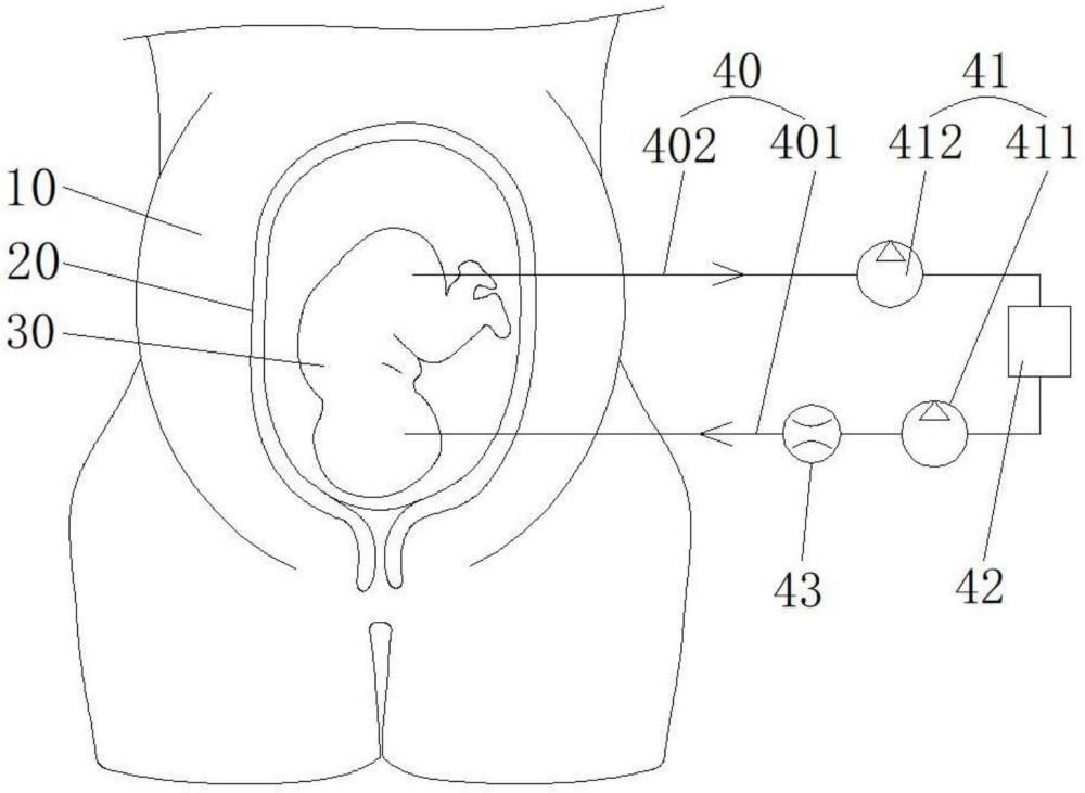 一種孕婦四步觸診教學(xué)模型用自動充裝裝置的制作方法