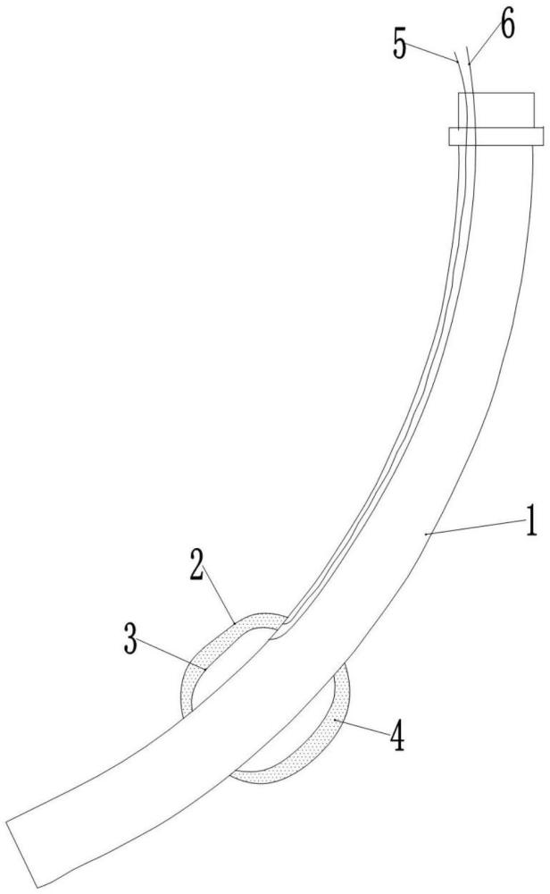 氣管導管及其使用方法