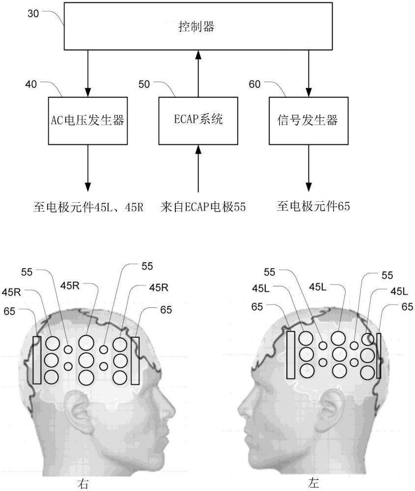 在使用交流電場治療受試者時使用閉環(huán)技術(shù)減少電感的制作方法