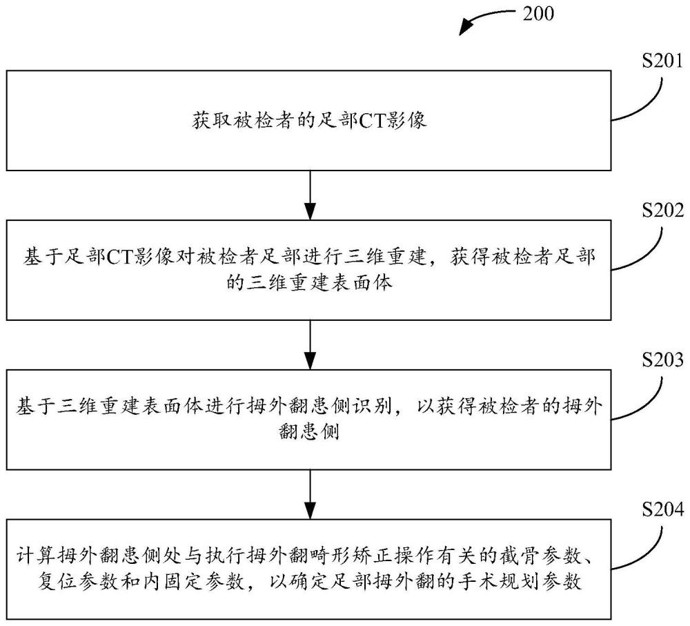 確定足部拇外翻的手術(shù)規(guī)劃參數(shù)的方法及相關(guān)產(chǎn)品與流程