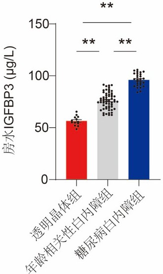 一種IGFBP3蛋白作為白內(nèi)障標(biāo)志物及其應(yīng)用的制作方法