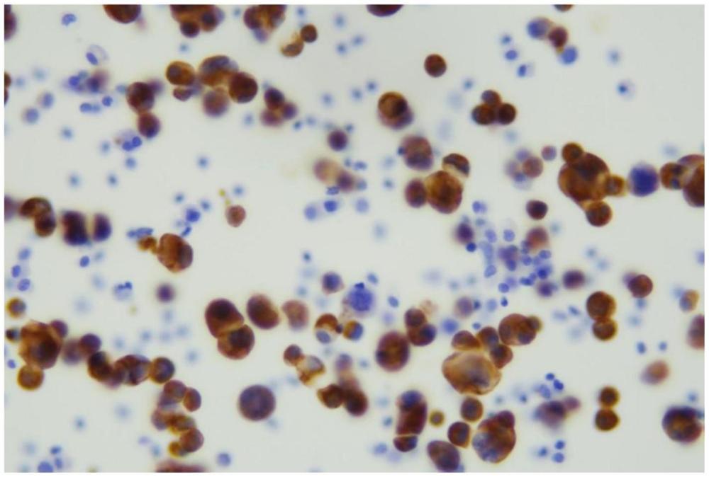 一種細胞清洗液、漿膜腔液基細胞處理用試劑組合、漿膜腔液基細胞染色試劑盒及染色方法與流程