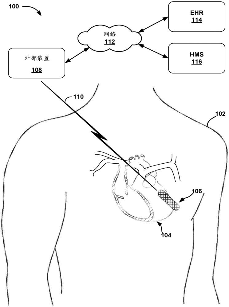 使用心率變異性特征來(lái)預(yù)測(cè)醫(yī)療手術(shù)功效的系統(tǒng)的制作方法