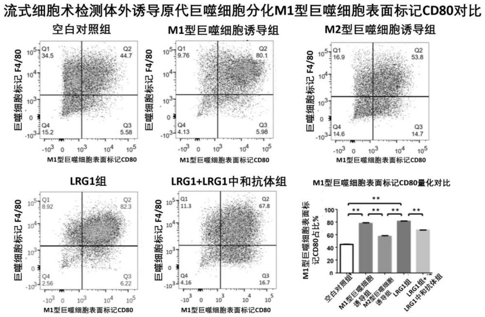 抗LRG1抗體及其應用