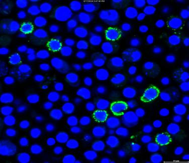 抗大黃魚CD8α單克隆抗體及其制備方法