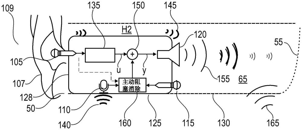 用于聽(tīng)力設(shè)備的阻塞和噪聲消除系統(tǒng)及方法與流程