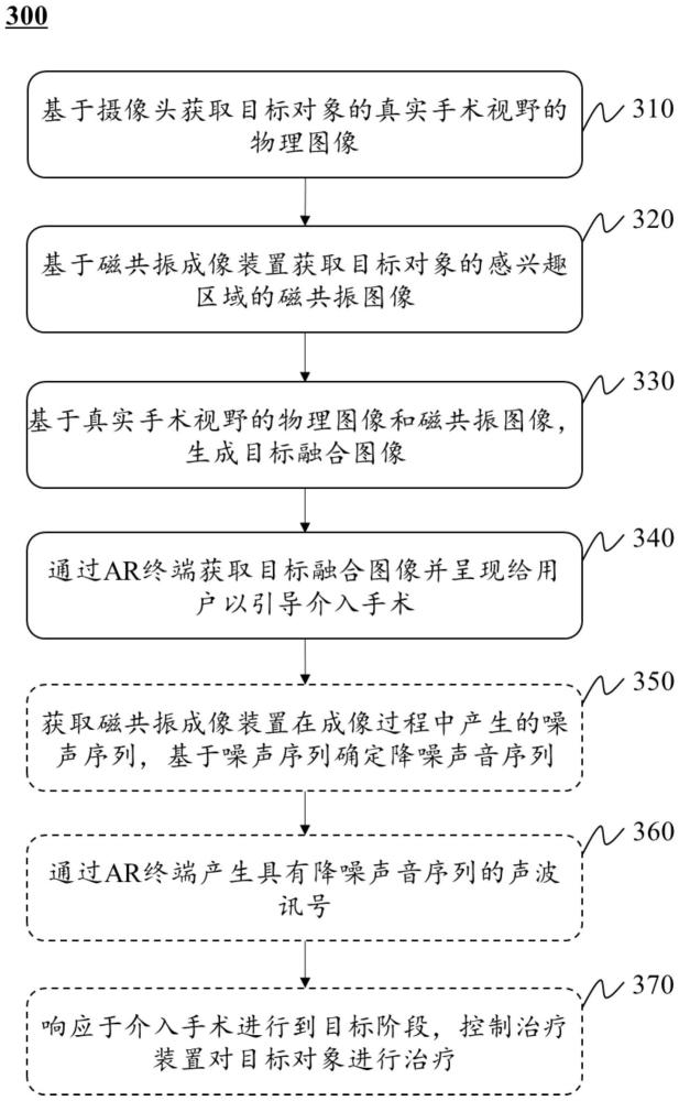 一種磁共振成像引導介入手術(shù)系統(tǒng)和方法與流程