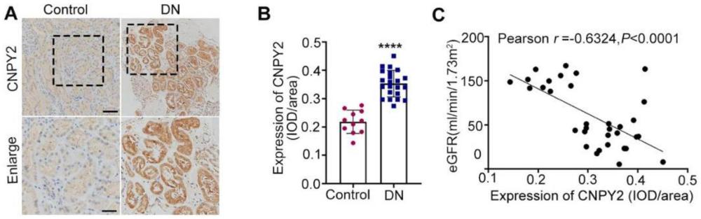 CNPY2作為新靶標(biāo)在糖尿病腎病診斷和治療中的應(yīng)用