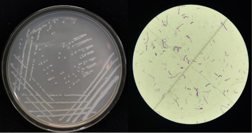 一種抗煙草花葉病毒的蠟樣芽孢桿菌C1-3及其應(yīng)用和煙草種植方法