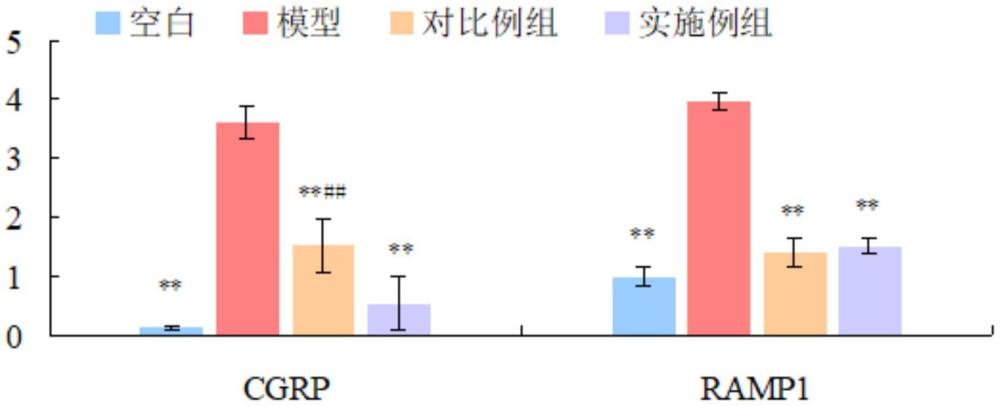 一种治疗偏头痛中药配方的制备方法